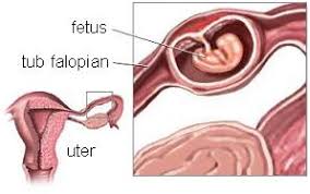 Când apar primele simptome de sarcină. Progesteron In Sarcina Forum Despre ViaÈa Din Romania