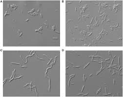 We did not find results for: Morphology Of E Coli Cells Under Microscope At 100 Magnification Download Scientific Diagram