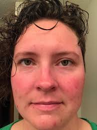 Hello, first time making a post here 🙂. I just wanted to mention that  Heidi German was an absolute amazing friend and helped me get the clear  proof 4 step set for