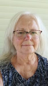 Face-lift for a 71 year old woman?