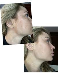 Kerry Macleod (@km_skin) • Instagram photos and videos