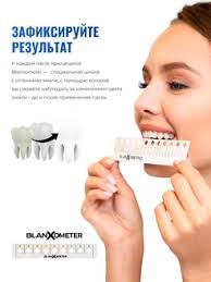 Зубная паста Coco White с экстрактом кокоса, 75 мл blanx 143822588 купить  за 574 тг. в интернет-магазине Wildberries