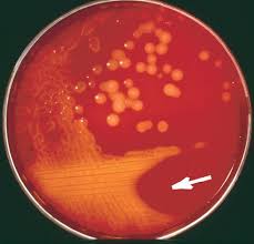 Visit chemicalbook to find more columbia cna agar() information like chemical properties,structure,melting point,boiling point,density,molecular formula,molecular weight. Primary Purpose Of Culture Media Used For Routine Bacteriology Learn Microbiology Online