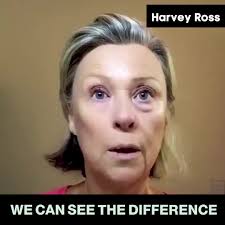 Harvey Ross Instant Eye Lift