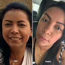 𝐃𝐑 𝐍𝐎𝐑𝐀 𝐒𝐓𝐀𝐍𝐅𝐎𝐑𝐃 𝐏𝐥𝐚𝐬𝐭𝐢𝐜 S𝐮𝐫𝐠𝐞𝐨𝐧