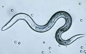You want to go to the toilet to empty your bowel. Back To School Worms To Watch Out For Cnn
