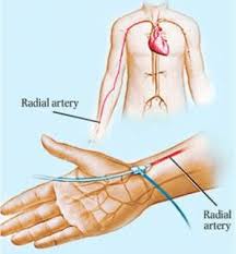 El Bileginden Anjiyo Ile Ayni Gun Taburcu Olabilirsiniz Ncr International Hospital 444 99 30