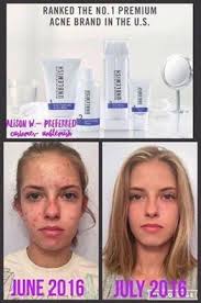 Kira Berry (kiwirazzleberry)