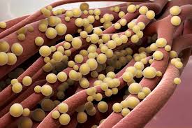 Image result for Staphylococcus Aureus