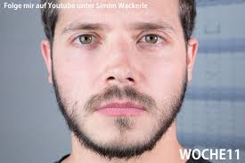 Minoxidil Bart Erfahrungsbericht über zwei Jahre mit Bildern