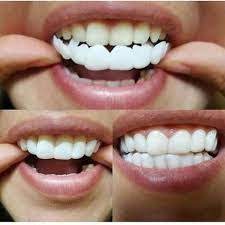 This is likely very different from what lies underneath. Veneers Cost And Benefits Uptown Dentist In Houston Tx Urbn Dental Veneers Teeth Veneers Teeth Cost Snap On Smile