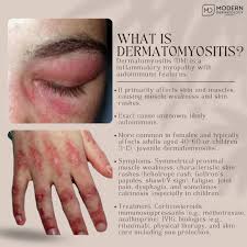 Image result for Dermatomyositis
