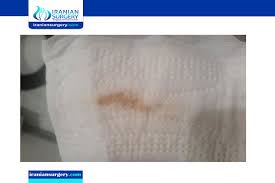 ماهو الوضع العائلي ؟ نوع العرض. ØªØ¬Ù†ÙŠØ¯ Ø²Ù…ÙŠÙ„ ØªØ³Ø·ÙŠØ± Ù†Ø²ÙˆÙ„ Ø®ÙŠÙˆØ· Ø¯Ù… Ù…Ø¹ Ø§Ù„Ø§ÙØ±Ø§Ø²Ø§Øª ÙÙŠ Ø§Ù„Ø´Ù‡Ø± Ø§Ù„ØªØ§Ø³Ø¹ Sjvbca Org