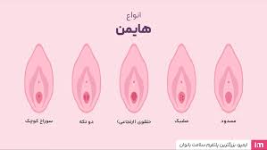 همه چیز در مورد پرده بکارت یا هایمن