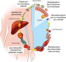 Le paludisme ou la malaria, appelé également « fièvre des marais », est une maladie infectieuse due à un parasite du genre plasmodium, propagée par la piqûre de certaines espèces de moustiques anophèles. Eradication Du Paludisme Vers Un Traitement A 100 Efficace