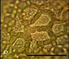 Image result for Bussea