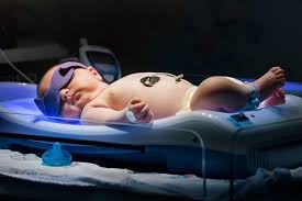 We did not find results for: Kenali Penyebab Bayi Kuning Dan Cara Mengatasinya Alodokter
