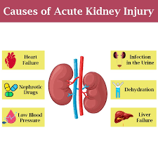 Causes Of Acute Kidney Injury Acute Kidney Injury Signs Of Kidney Failure Kidney Treatment