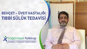 Behcet Uveit Hastaligi Tibbi Suluk Tedavisi Youtube