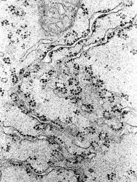 Phospholipid synthesis continues in the endoplasmic reticulum, and the biosynthesis pathway diverges depending on the components of the particular phospholipid. Endoplasmic Reticulum Rough And Smooth British Society For Cell Biology