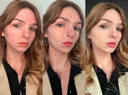 The 10 Best Concealers for Acne of 2025