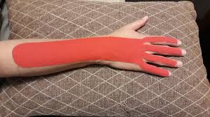Learn about the four most common causes and how to treat them. A Study Of Participants With Carpal Tunnel Syndrome And How They Felt With Kinesiology Taping Applied Rocktape