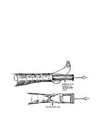Buck's traction or skin traction. Buck S Extension Traction Nursing Care Musculoskeletal System Musculoskeletal System Nursing Care Nurse