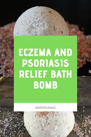 Eczema Psoriasis Bath Bomb Eczema Bath Psoriasis Bath Organic Bath Bombs