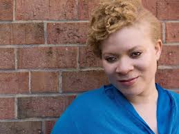 People Of Color With Albinism Ask: Where Do I Belong?