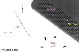 Image result for lice vs nits