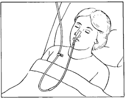 Nasogastric (ng) tube placement is one of the most common procedures performed in intensive care settings, the emergency department, and hospital wards. Nasogastric Tube Definition Of Nasogastric Tube By Medical Dictionary