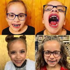 Claire officially got braces this week! Check out how it affects her  singing!