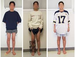 Image result for Pediatric Leg Disorder
