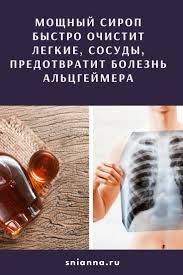 как почистить сосуды в домашних условиях быстро и эффективно Pin Na Doske Zdorove