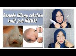 Cara Menghilangkan Komedo Dengan Pasta Gigi Youtube