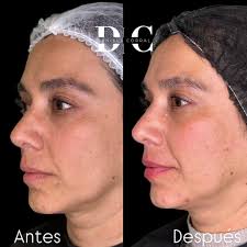 Regenera tu piel de los daños con Crystal Hydro PDRN✨ Una combinación de  ciencia avanzada con resultados visibles para lograr una piel más luminosa,  firme e hidratada. 🌿💧 Este tratamiento utiliza PDRN,