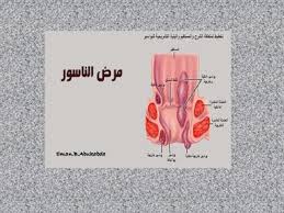 pin on وصفات منزلية لجمالك homemade beauty recipes