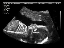 Free family planning and pregnancy services free pregnancy test & confidential counseling free ultrasound* financial assistance available *must meet qualifications. Dna Blood Test Gives Women A New Option For Prenatal Screening Shots Health News Npr