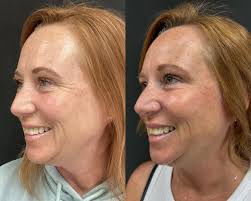 Katelin Dickson Spratt (@drk8spratt) • Instagram photos and videos