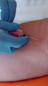 Image result for Venous Blood Sampling
