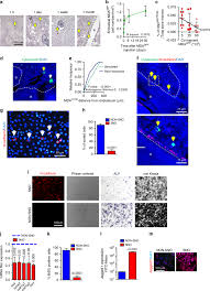 How to treat bone marrow cancer. Notch2 Pathway Mediates Breast Cancer Cellular Dormancy And Mobilisation In Bone And Contributes To Haematopoietic Stem Cell Mimicry British Journal Of Cancer