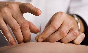 Easing Your Pain With Acupuncture