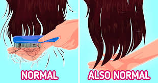 Generally speaking normal hair loss per day is between 150 and 200 hairs. 7 Ways To Tell If You Re Losing Too Much Hair