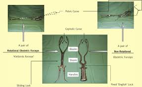 Told initially they may have to do c section, then forceps, then c section. References In Instrumental Vaginal Delivery Obstetrics Gynaecology And Reproductive Medicine