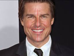 Cosmetic dentists believe that the actor had a surgery to make his teeth shifted to the right, but the result was a. What Is Wrong With Tom Cruise S Teeth Quora