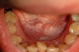 We did not find results for: Cannabis Adverse Effects From An Oromucosal Spray British Dental Journal