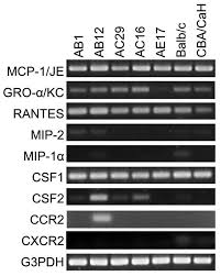 Transient knockdown of zeb1 expression with rna interference in four malignant pleural mesothelioma cell lines dramatically suppressed their in vitro growth. Regulated Chemokine Gene Expression In Mouse Mesothelioma And Mesothelial Cells Tnf A Upregulates Both Cc And Cxc Chemokine Genes