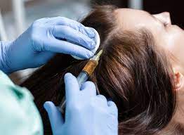 What is the mesotherapy hair treatment? - Ribe Clinic