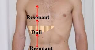 Percussion Of Lower Border Upper Border Of Liver Right Mcl Starting At A Level Below The Umbilicus In The Rig Nursing Assessment Family Medicine Aprn