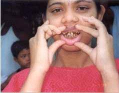 Fluorine gas F is the second most powerful oxidizing agent known, reacting  with practically all organic and inorganic substances